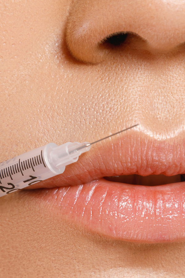 About Fillers Queanbeyan